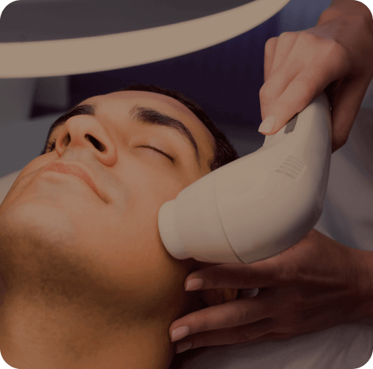 laser treatment